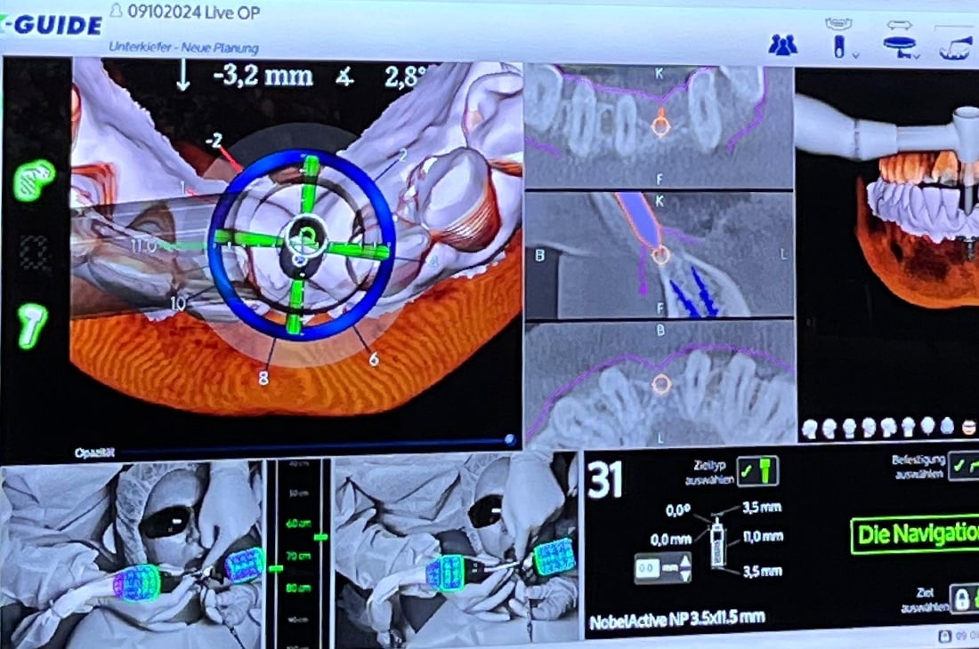 Inforveranstaltung – X-Guide